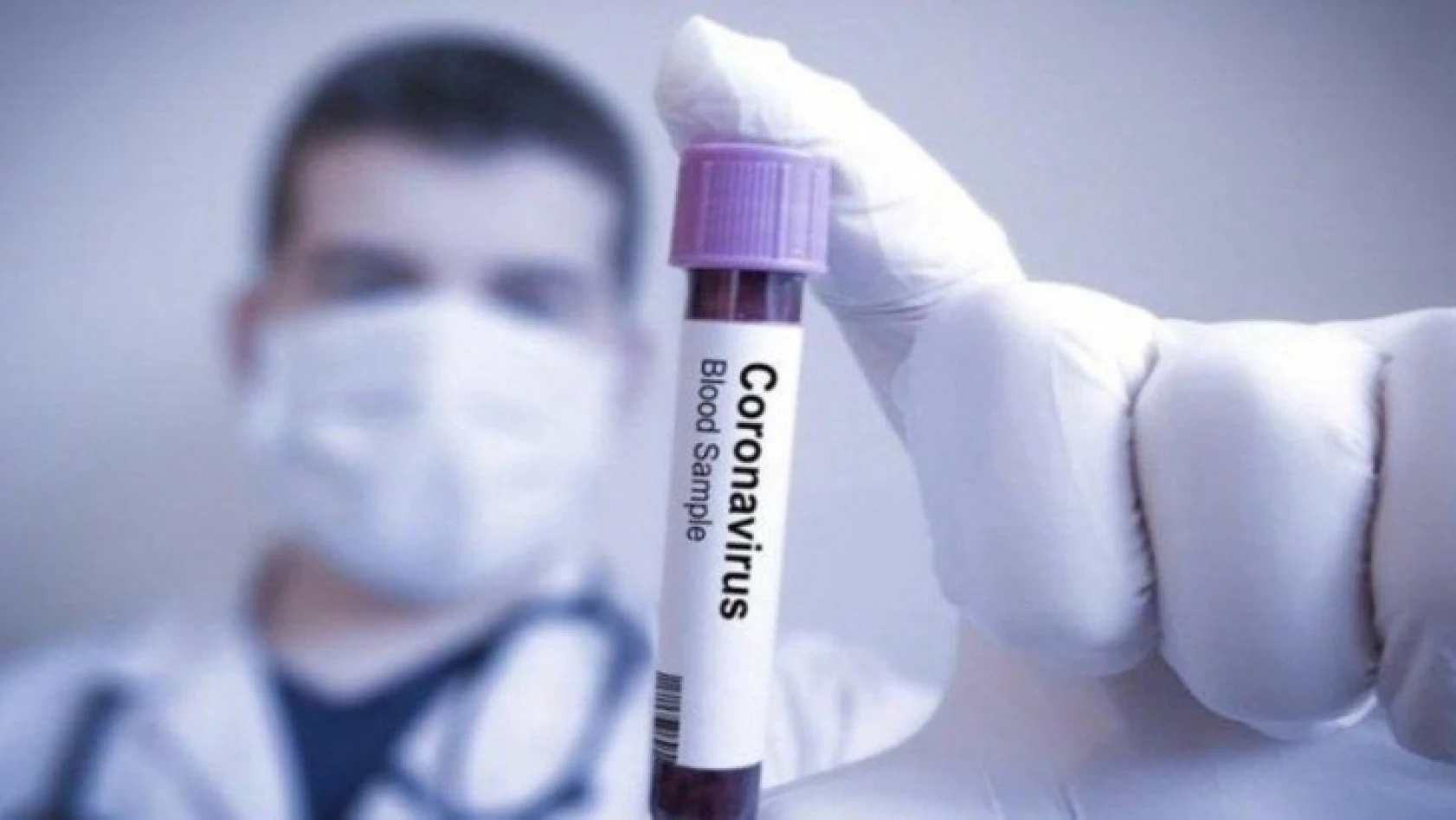 Çinli doktordan Türkiye'ye koronavirüs uyarıları