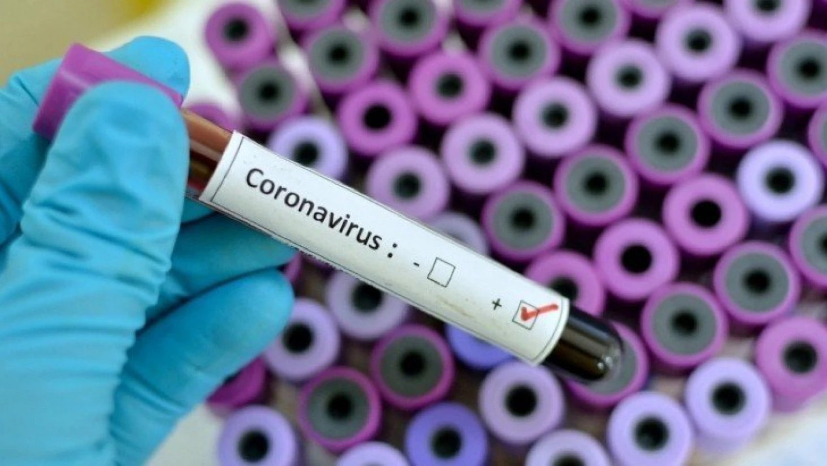 Coronavirüs salgını için Türkiye'de en riskli şehirler hangileri? Bilim Kurulu üyesi açıkladı...