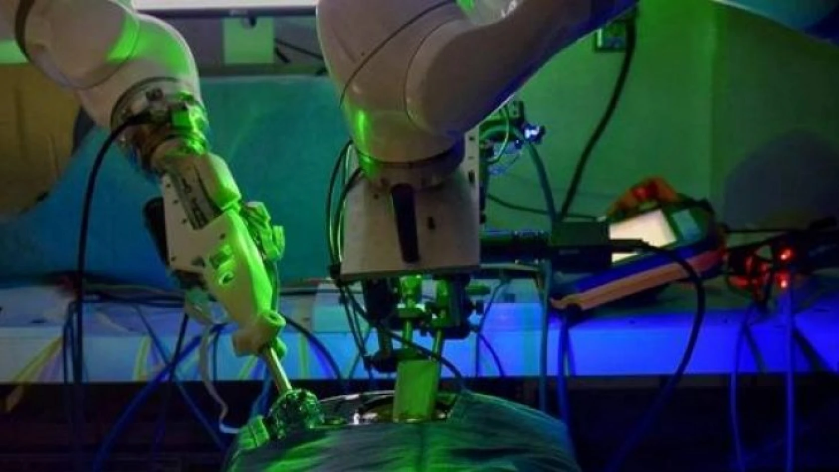 Dünyada bir ilk! Robot, insan yardımı olmadan ameliyat yaptı!
