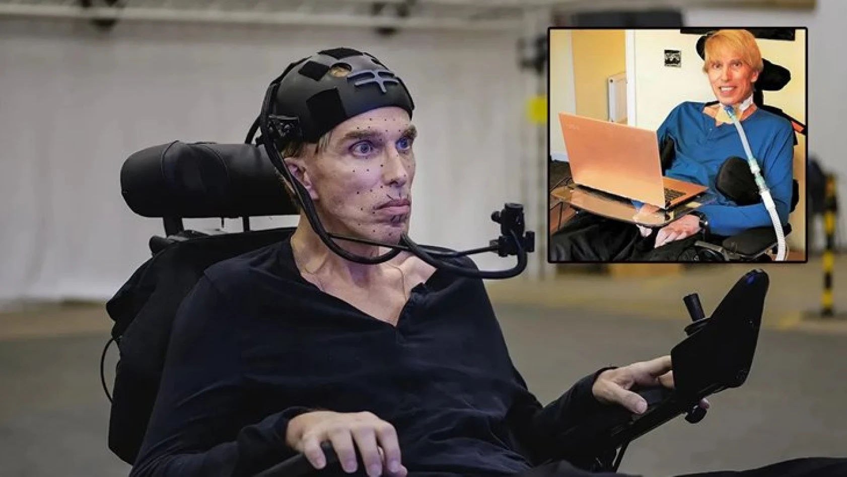 Dünyanın ilk cyborg'u Dr. Peter Scott-Morgan, hayatını kaybetti