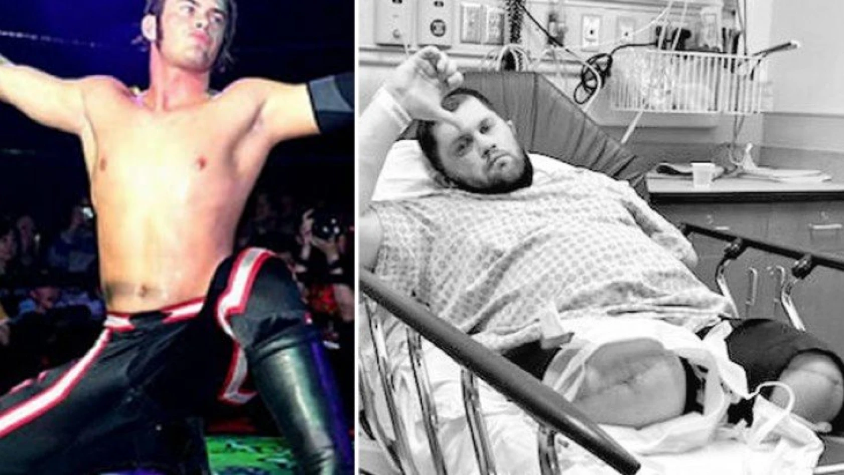 Güreş yıldızı Jimmy Rave'in önce bir kolu şimdi de iki bacağı kesildi