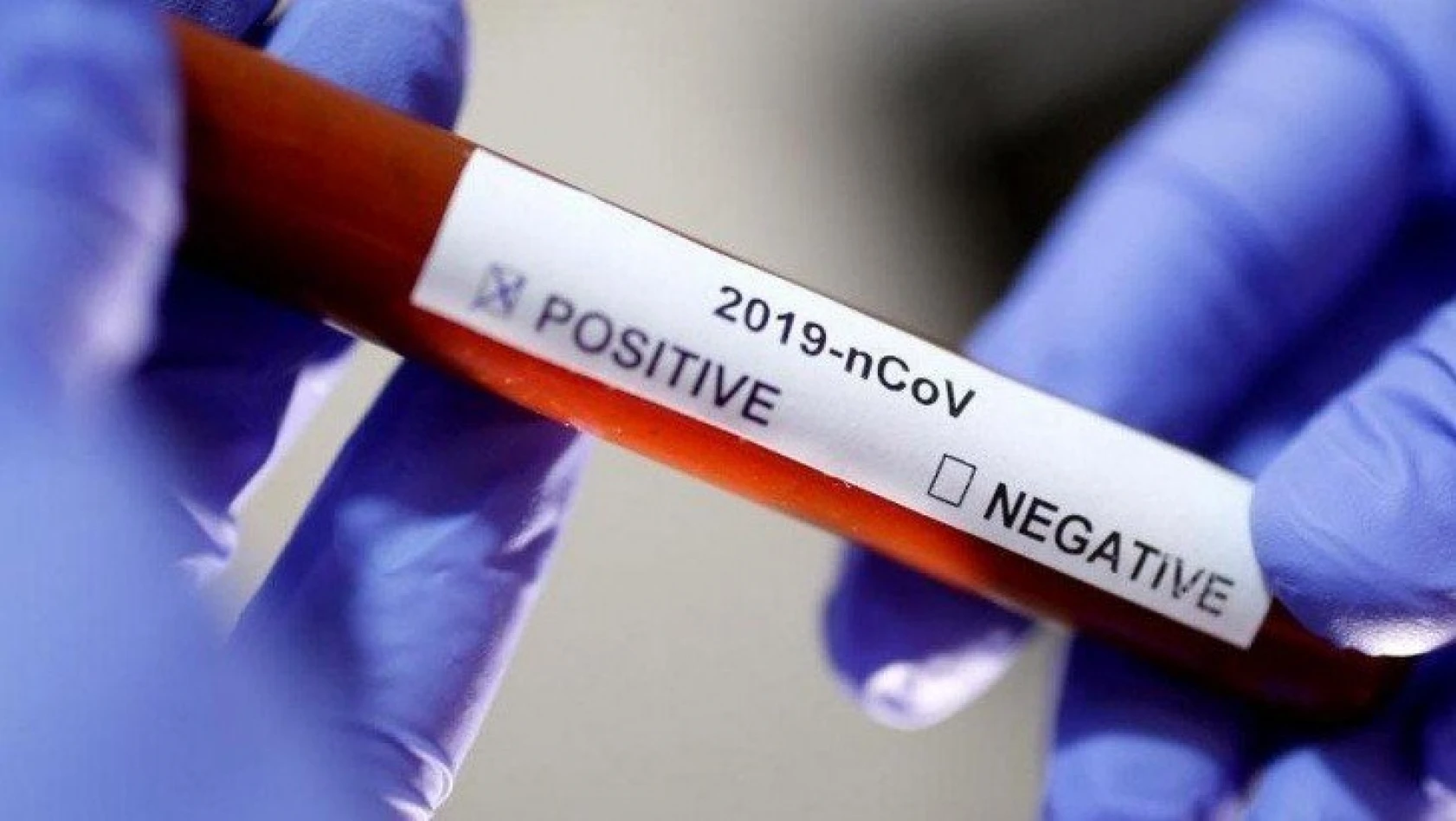 İsviçre'de corona virüsü aşısı geliştirildi: Ekim'de başlıyor