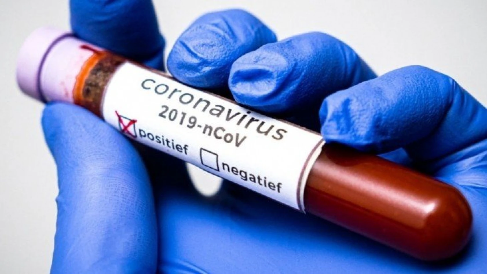 Korona virüsü salgını ne zaman bitecek?
