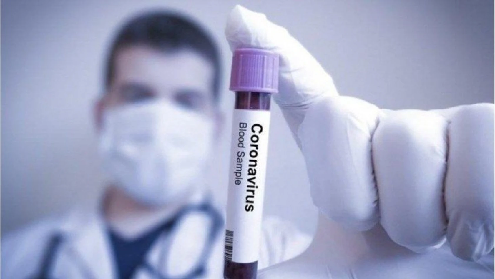 Korona virüsün 3 yeni belirtisi ortaya çıktı