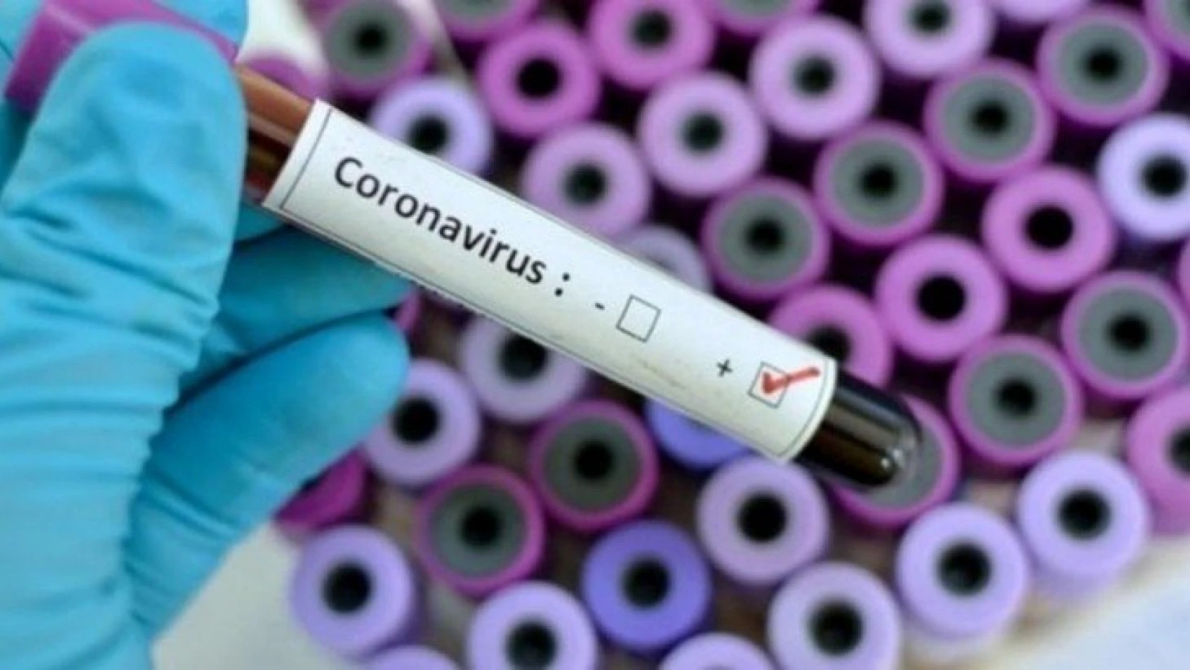 Koronavirüs en çok o kan grubunu etkiliyor