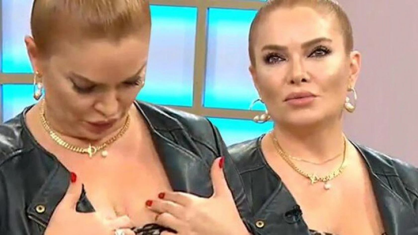 Şarkıcı Pınar Eliçe, cilt kanserine yakalandığını açıkladı