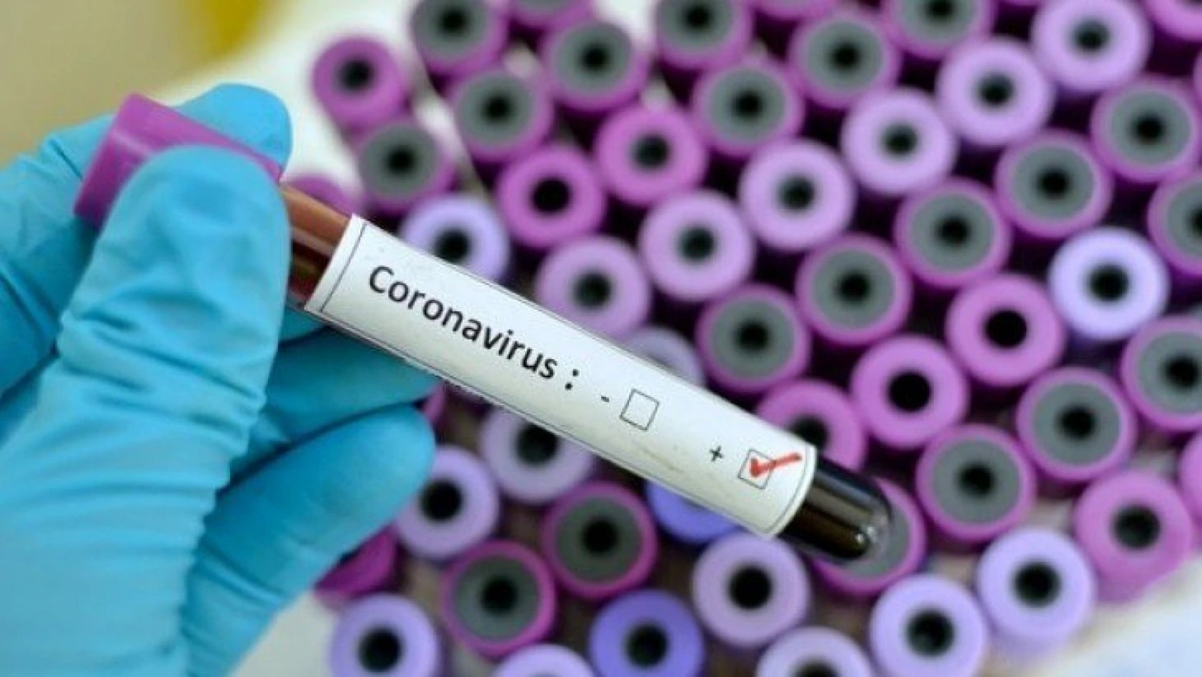 Türkiye'deki son corona virüsü vakaları açıklandı