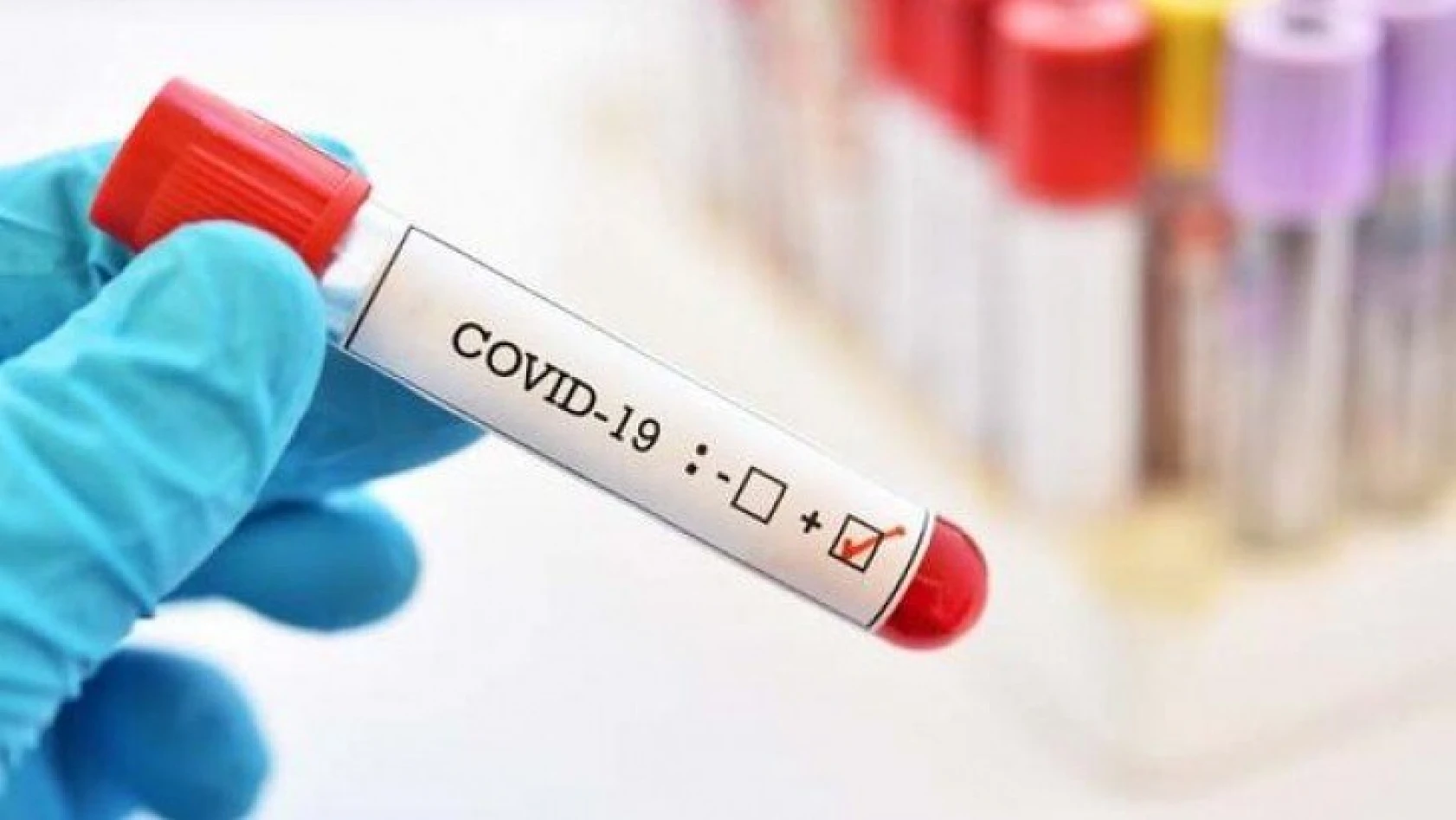 Türkiye'deki yeni corona virüsü vakaları ve can kaybı açıklandı
