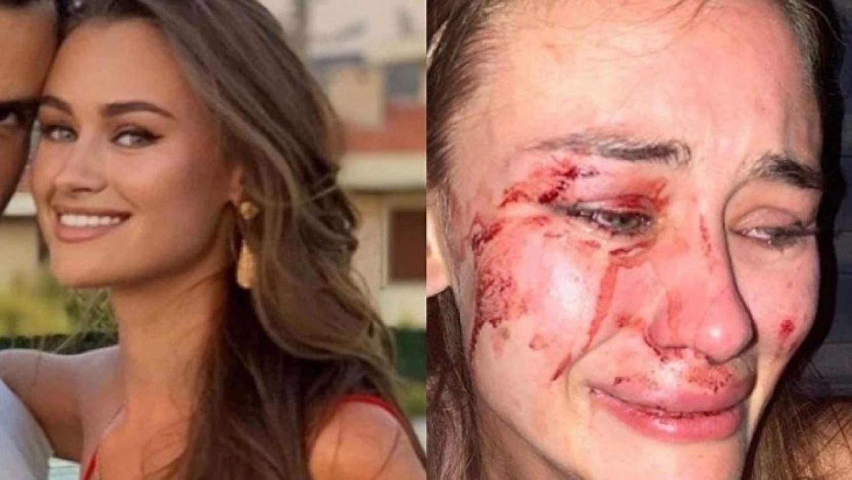 Ünlü model Daria Kyryliuk İzmir'de güvenlik görevlilerinin saldırısına uğradı