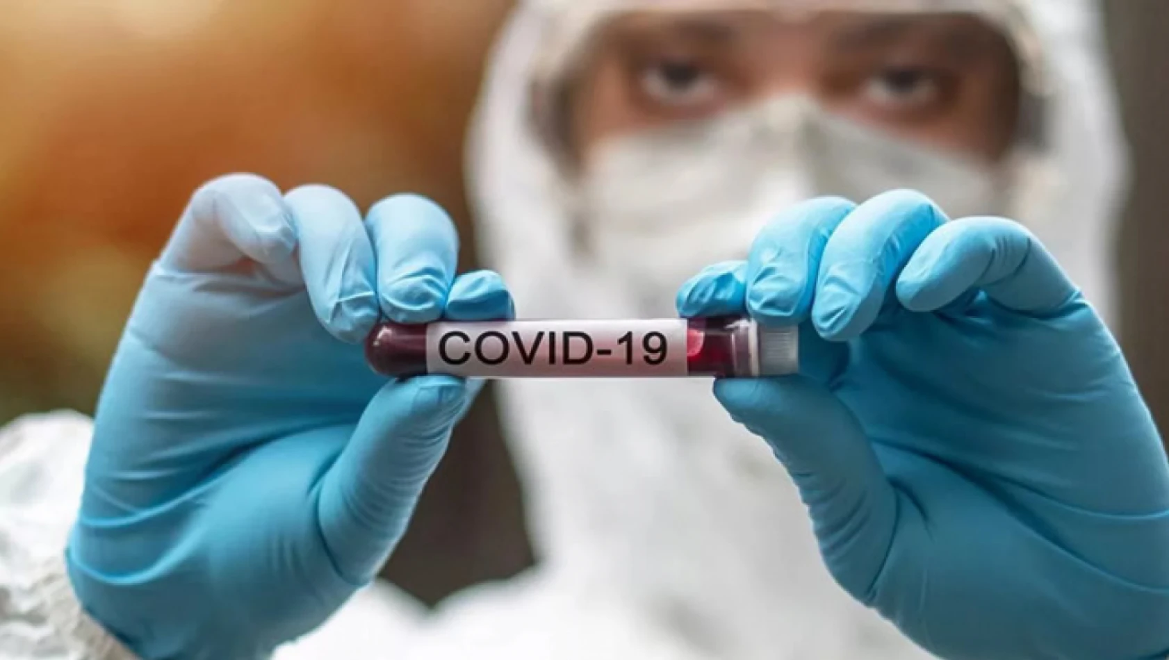 Koronavirüs yeniden hortladı! Eris varyantı için uzmanlar, Eylül ayına dikkat çekti!